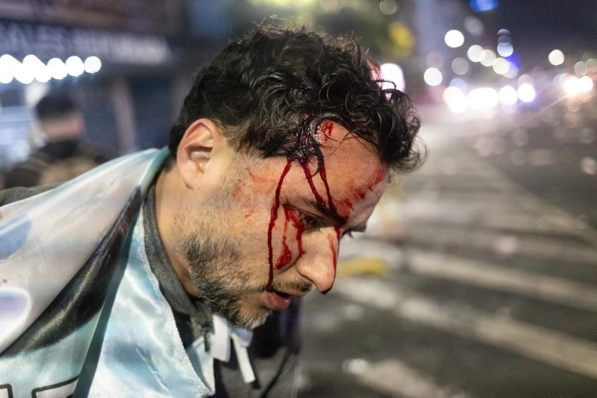 Chaos Erupts at Obelisco: Celebrations for World Cup Final Descend into Violent Clashes with Police
