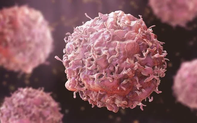 Kano Cancer Treatment Centre CEO Urges Vigilance Against Sarcoma as Rare Cancer Awareness Month Commences