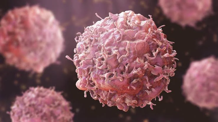 Kano Cancer Treatment Centre CEO Urges Vigilance Against Sarcoma as Rare Cancer Awareness Month Commences